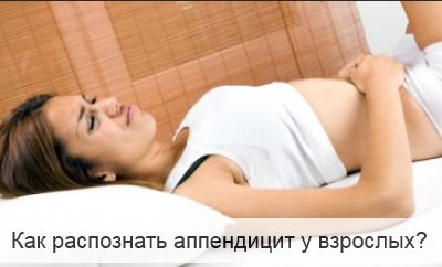 как распознать аппендицит у взрослых